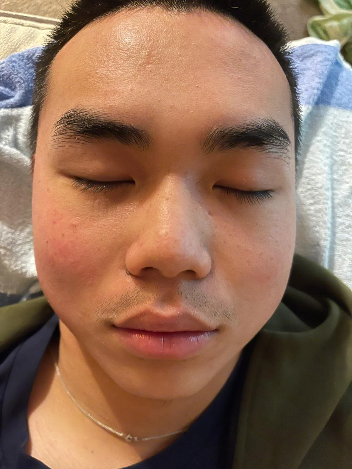 The same client's skin after treatment
