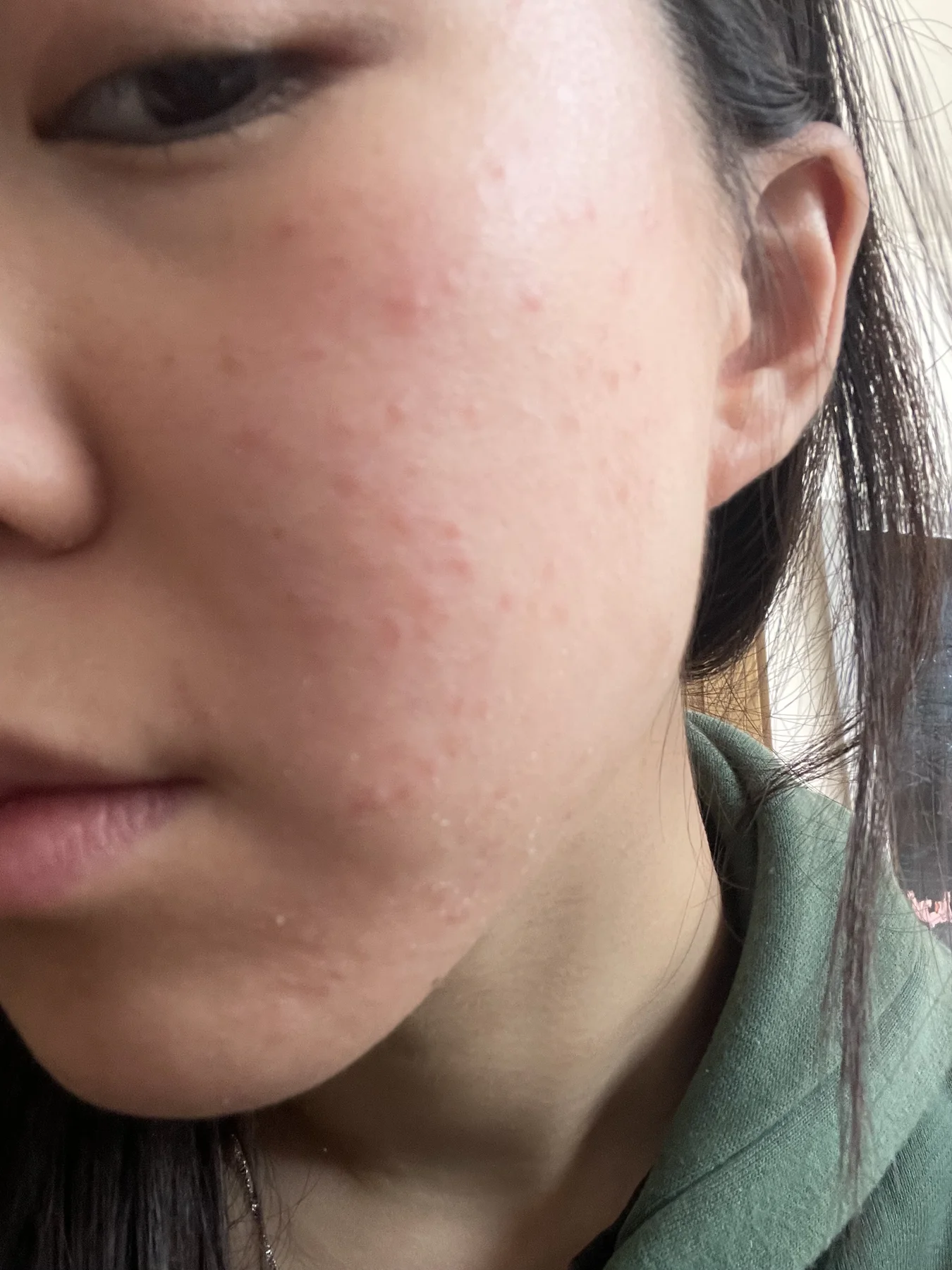 Close-up view of a woman's natural skin texture