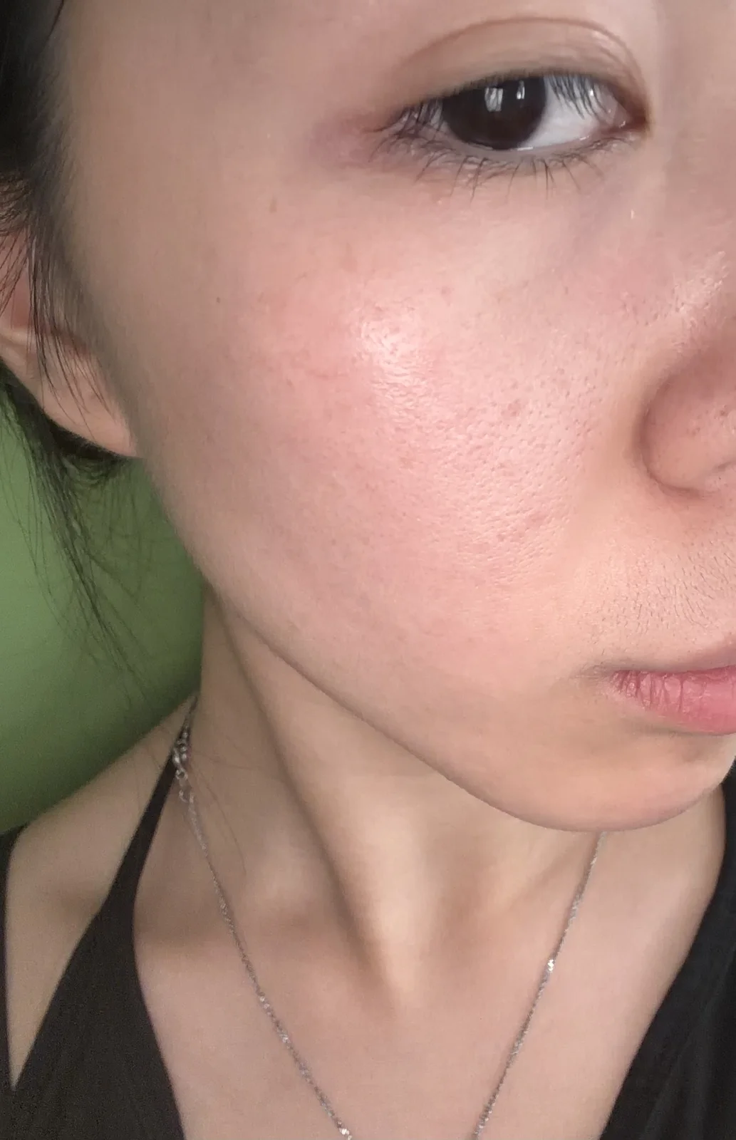 Close-up view of a woman's skin after care